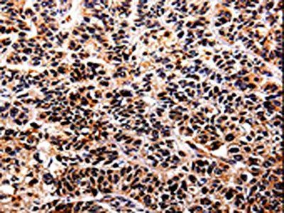IL10RA Antibody