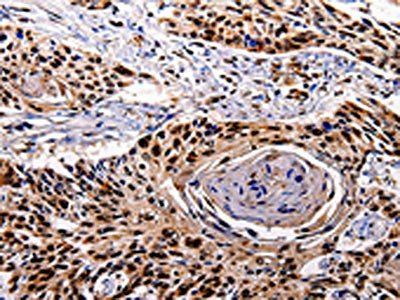IL10RB Antibody