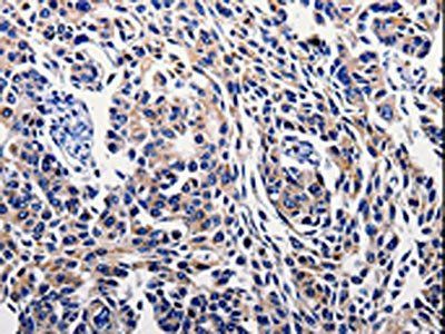 IL10RB Antibody