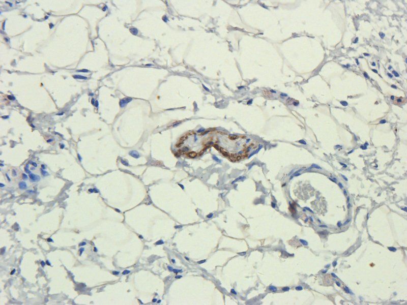 IL11 antibody