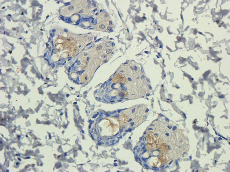 IL11 antibody