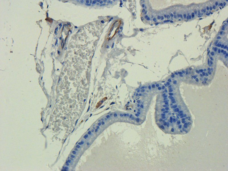 IL11 antibody