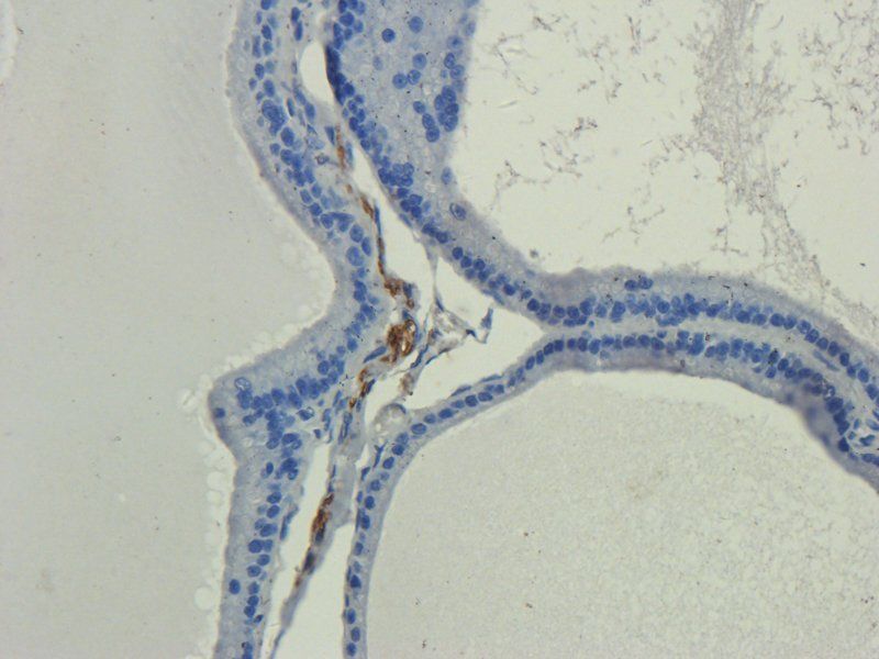 IL11 antibody