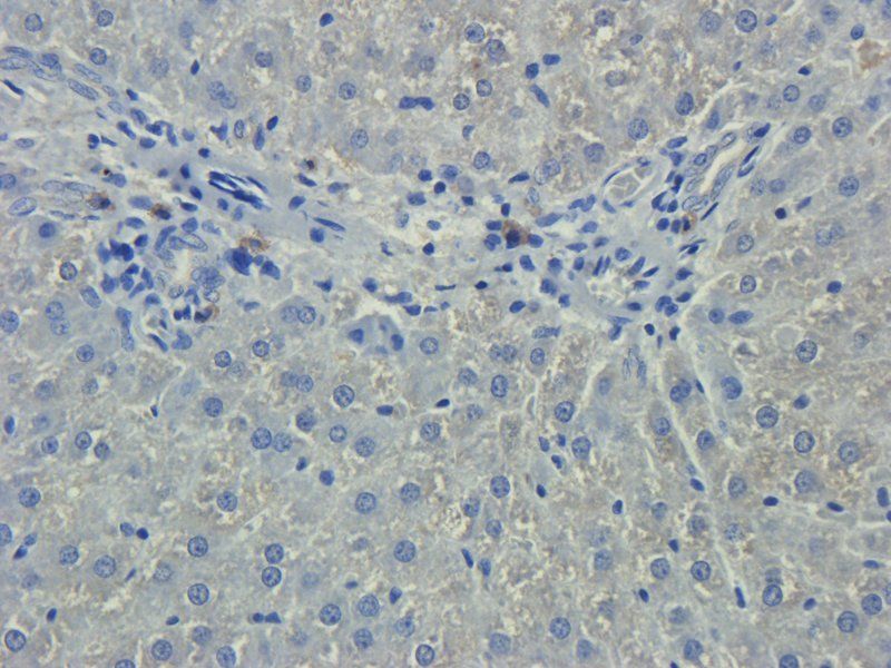 IL11 antibody