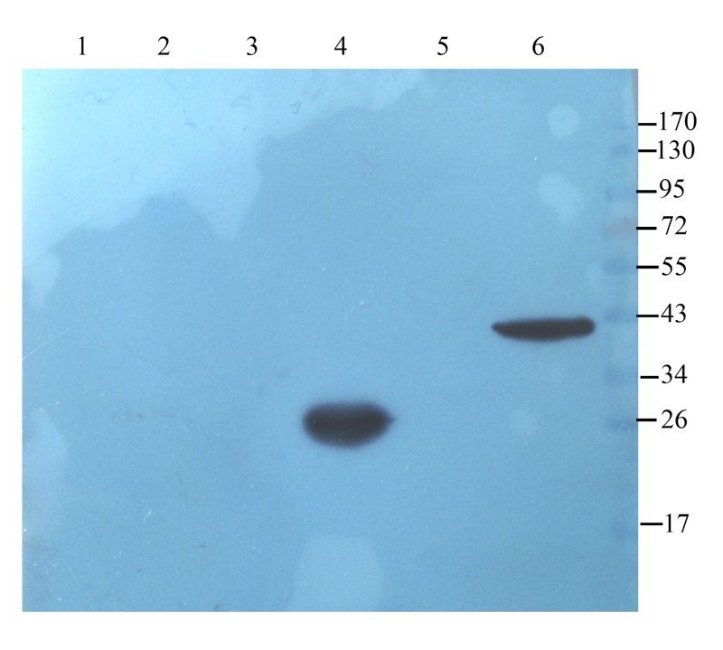 IL11 antibody