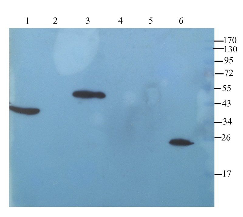 IL11 antibody