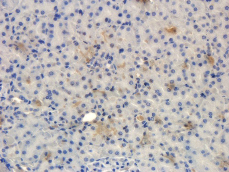 IL11 antibody