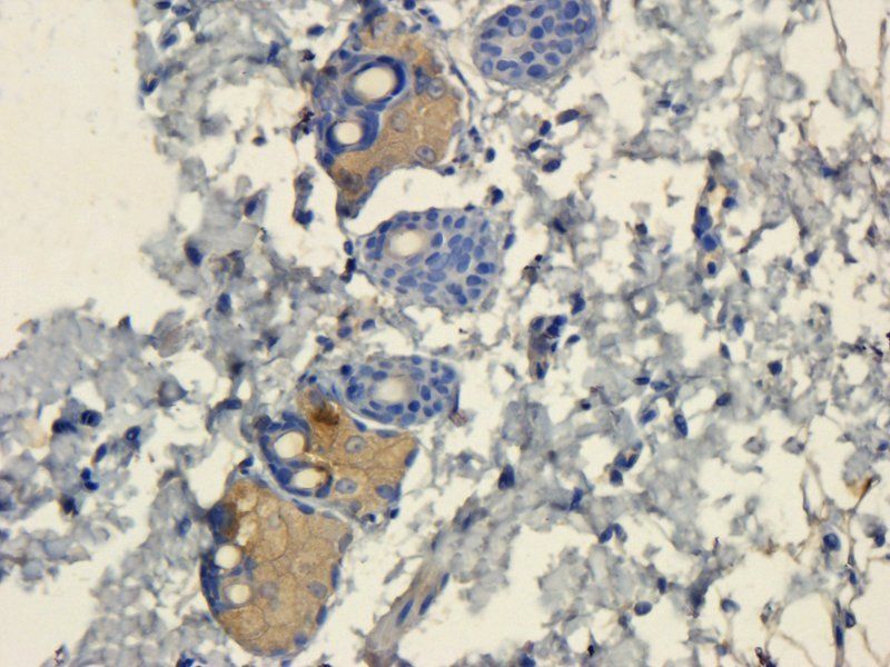 IL11 antibody