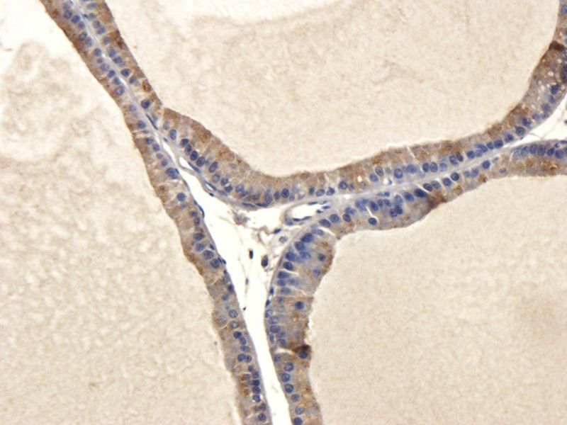 IL11 antibody