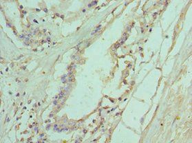 IL11RA Antibody