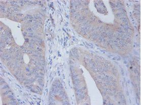 IL12B Antibody