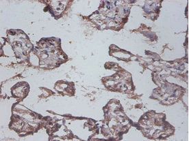 IL12 p40 antibody