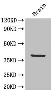 IL12B Antibody