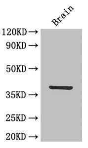 IL12 p40 antibody