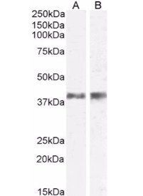 Goat anti-Il12b / Il12p40 (mouse) Antibody