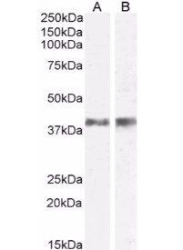 IL12 p40 antibody