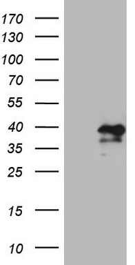 IL12A Antibody