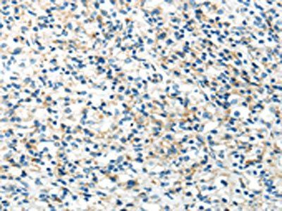 IL12A Antibody