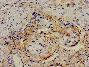 IL12A Antibody