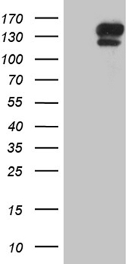 IL12B Antibody