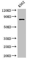 IL12RB1 Antibody