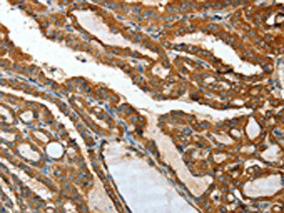 IL12RB1 Antibody