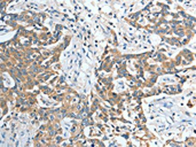 IL12RB1 antibody