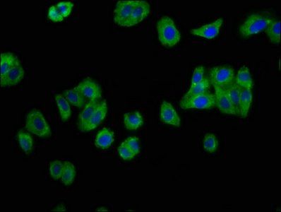 IL12RB2 Antibody