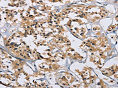 IL12RB2 Antibody