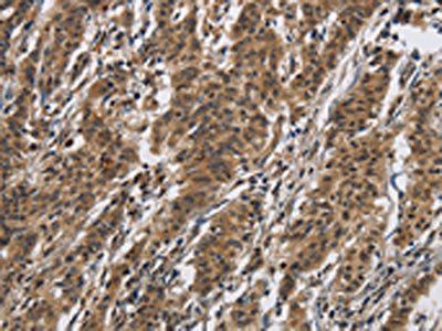 IL12RB2 Antibody