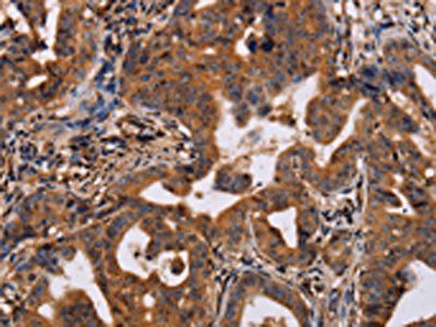 IL12RB2 Antibody