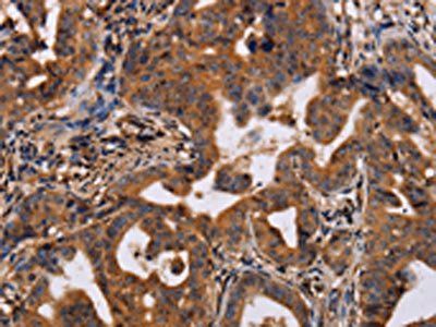 IL12RB2 antibody