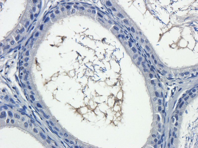 IL13 antibody