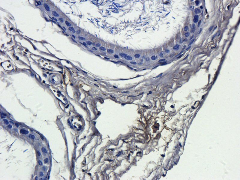IL13 antibody