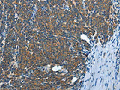 IL13RA2 Antibody