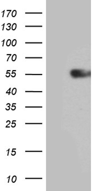 IL15RA Antibody