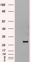 IL15RA Antibody