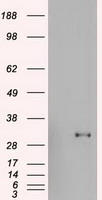 IL15RA Antibody