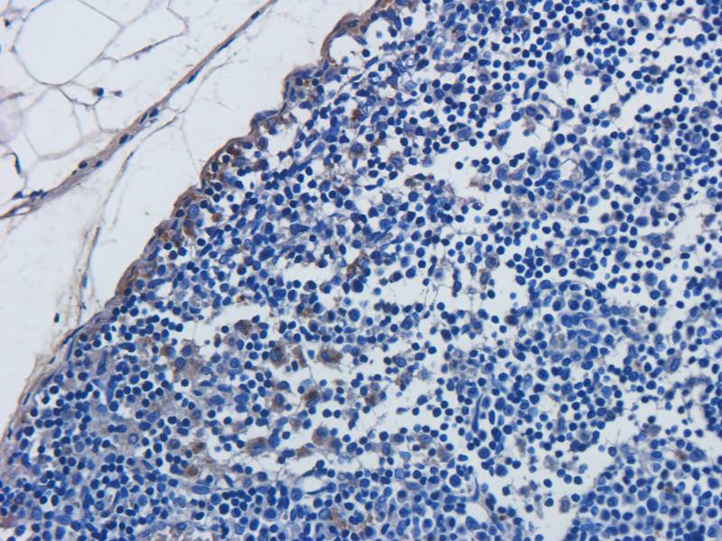 IL16 antibody
