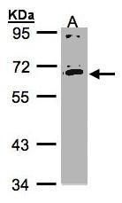 Mesothelin antibody [N1C2]