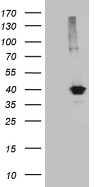 IL17B Antibody