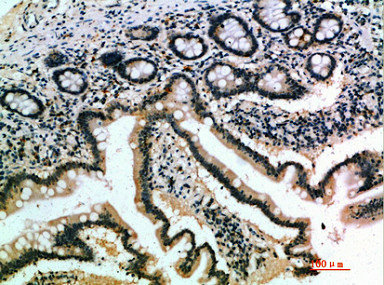 IL17B Antibody