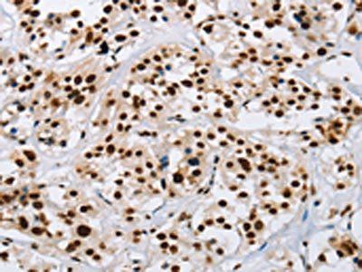 IL17C Antibody