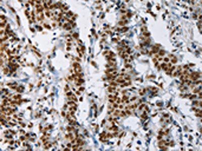 IL17C antibody