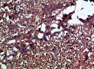 IL17C Antibody