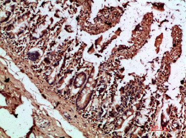 IL17C antibody