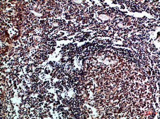 IL17D antibody