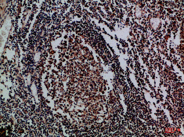 IL17D antibody