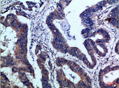 IL17F Antibody