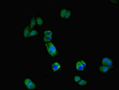 IL17RA Antibody